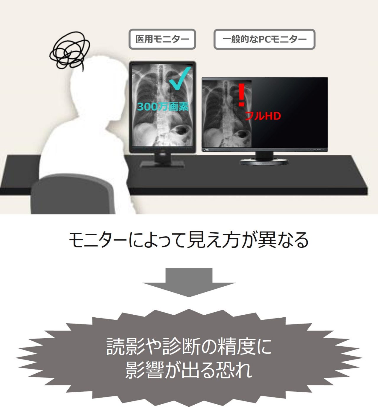 医用モニターとは？一般的なPCモニターとの違いと求められる性能 | 役立つコンテンツ一覧 | 医用モニター / 産業用モニター | JVC