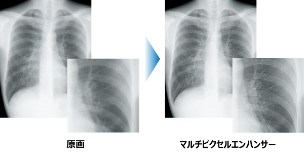 原画 → マルチピクセルエンハンサー