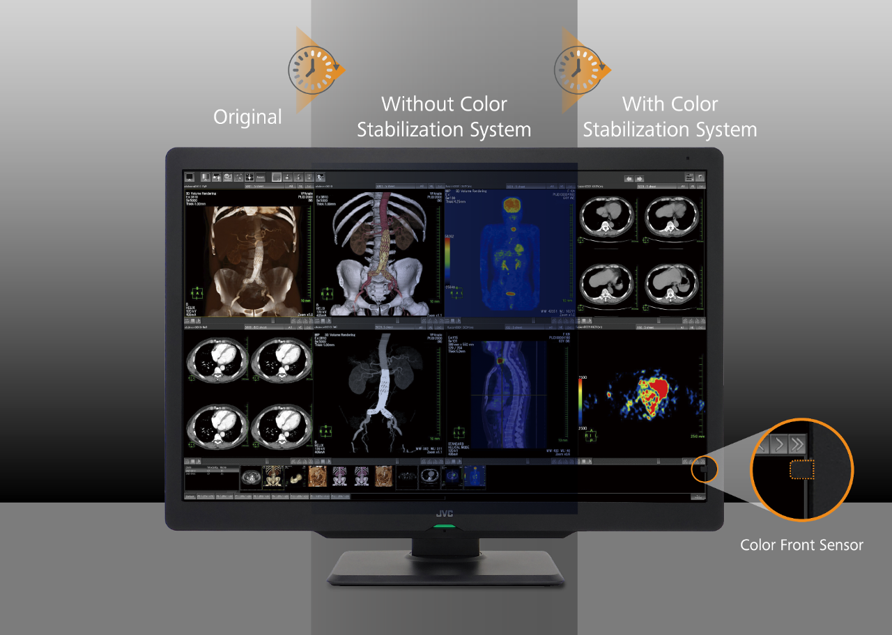 JVC to launch the CLS600, a 30inch medical imaging monitor News