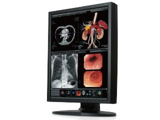200万画素21.3型カラー液晶モニターCCL214 | 医用モニター