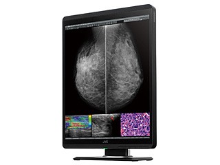 500万画素21.3型カラー液晶モニターCL-S500 | 医用モニター