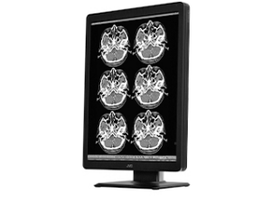 200万画素21.3型モノクローム液晶モニターMS-S200 | 医用モニター