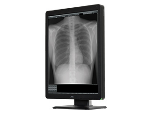 300万画素21.3型モノクローム液晶モニターMS-S300 | 医用モニター